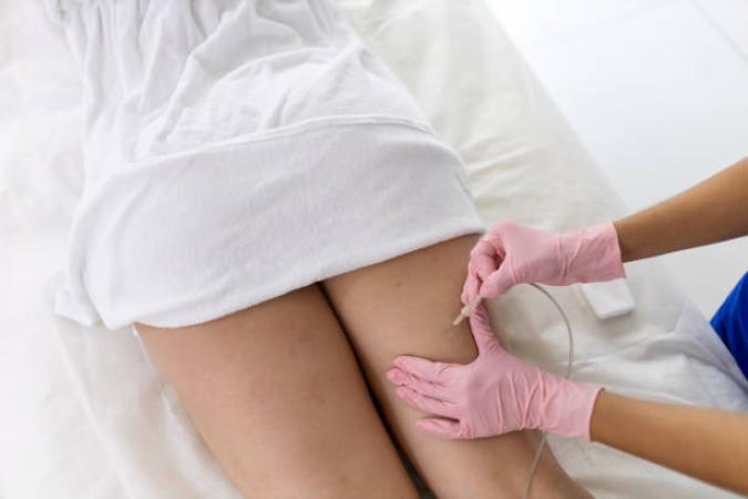 Carboxy Therapy