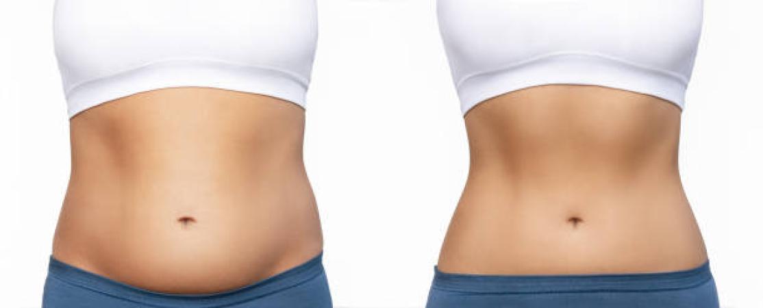 Cavitation 3D