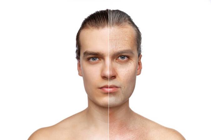 Mesotherapy