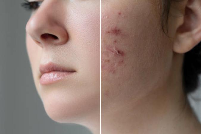 Carbon Clear Face