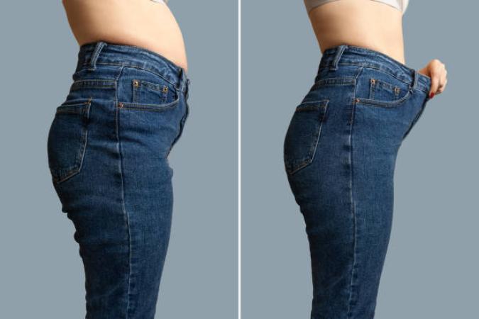 Lipo Laser
