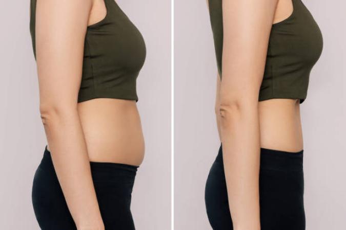 Carboxy Body
