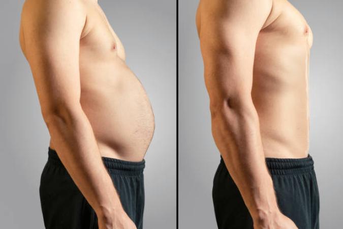 Exilis Elite