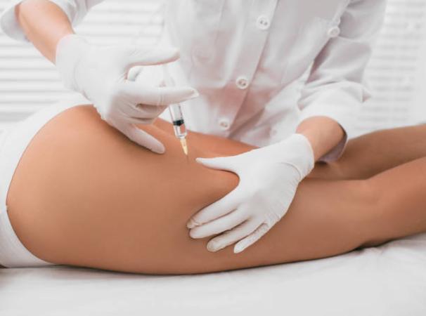 Mesotherapy