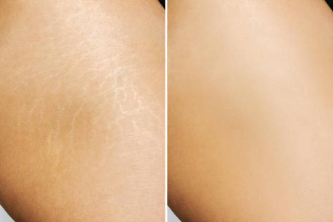 Fractional RF
